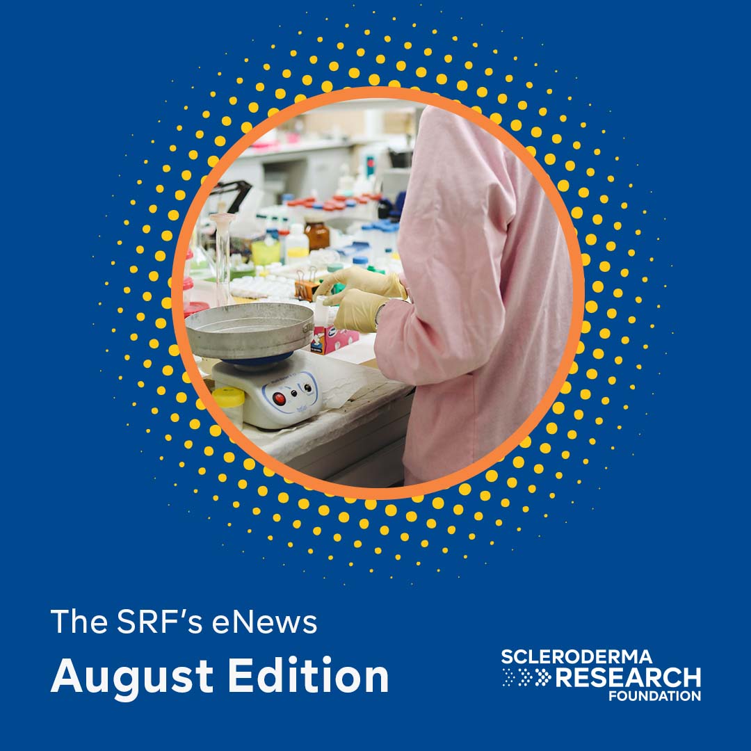 SRF eNews: August Edition