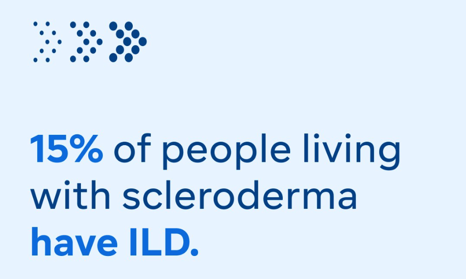 15% of people living with scleroderma have ILD