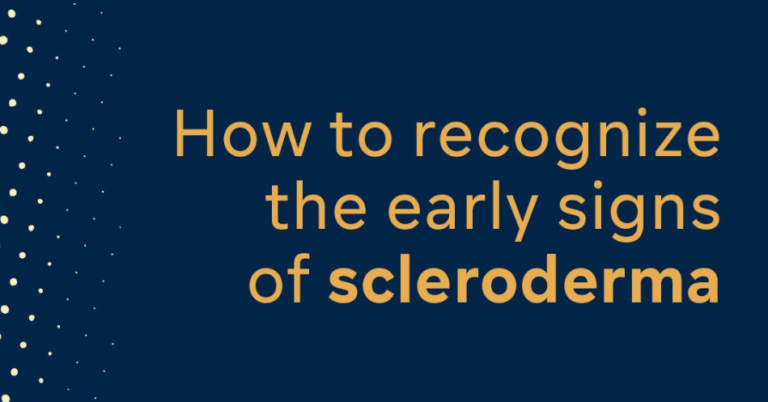 How To Recognize The Early Signs Of Scleroderma Scleroderma Research