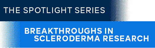 breakthroughs in scleroderma research