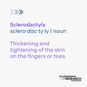 Sclerodactyly - Noun - Thickening and tightening of the skin on the fingers or toes.