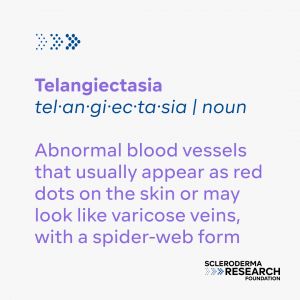 Telangiectasia - Noun - Abnormal blood vessels that usually appear as red dots on the skin or may look like caricose veins with a spider-web form