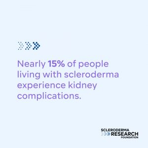 Nearly 15% of people living with scleroderma experience kidney complications