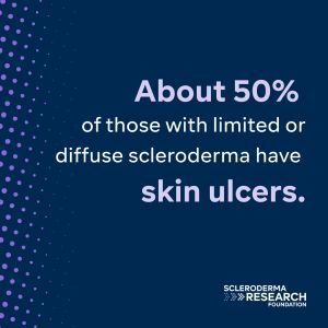 About 50% of those with limited or diffuse scleroderma have skin ulcers.